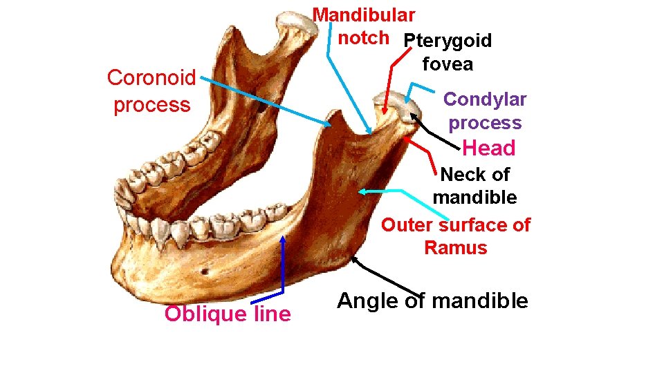 Coronoid process Mandibular notch Pterygoid fovea Condylar process Head Neck of mandible Outer surface