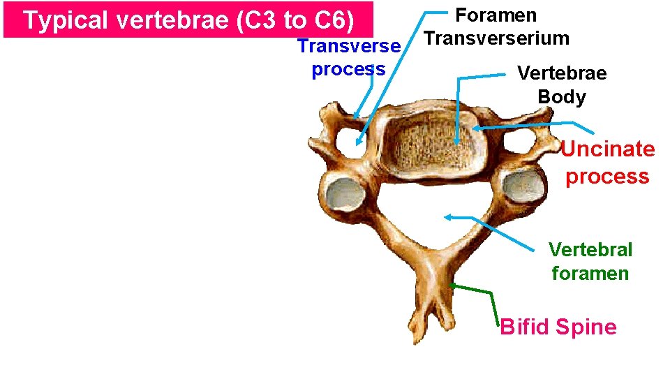 Typical vertebrae (C 3 to C 6) Transverse process Foramen Transverserium Vertebrae Body Uncinate