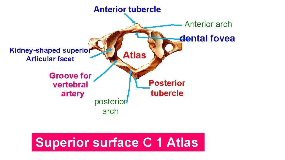 Anterior tubercle Anterior arch dental fovea Kidney-shaped superior Articular facet Groove for vertebral artery