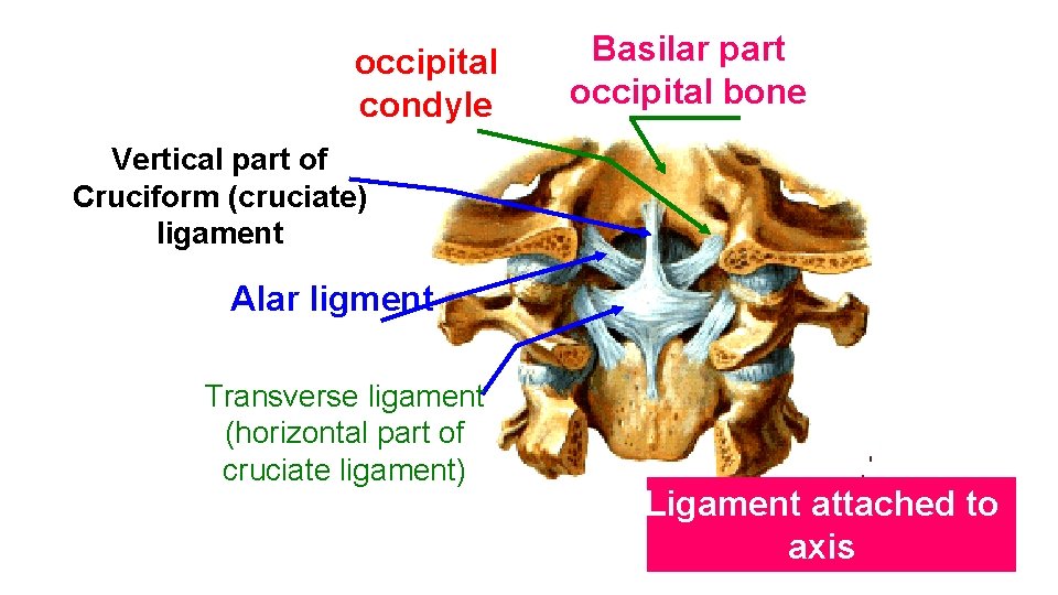 occipital condyle Basilar part occipital bone Vertical part of Cruciform (cruciate) ligament Alar ligment