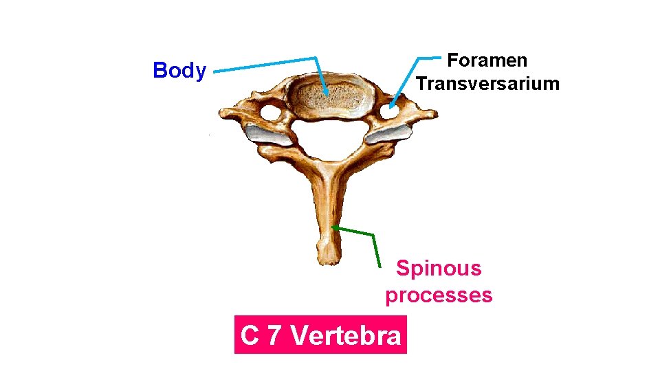 Foramen Transversarium Body Spinous processes C 7 Vertebra 