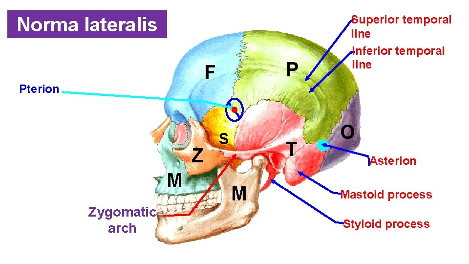 Norma lateralis P F Pterion Z M Zygomatic arch S T M Superior temporal