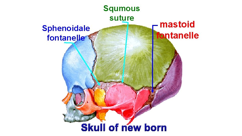 Squmous suture Sphenoidale fontanelle mastoid fontanelle Skull of new born 