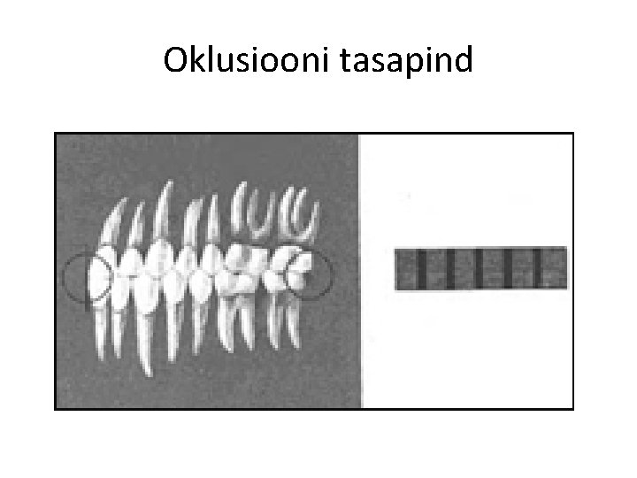 Oklusiooni tasapind 