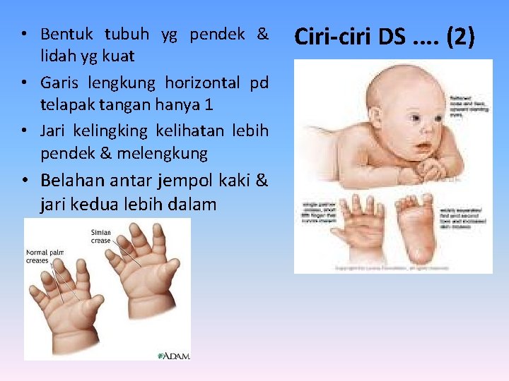  • Bentuk tubuh yg pendek & lidah yg kuat • Garis lengkung horizontal