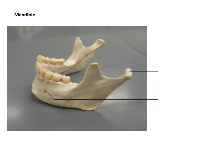 Mandible 