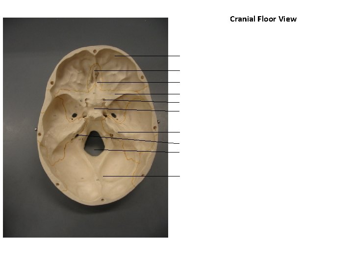 Cranial Floor View 