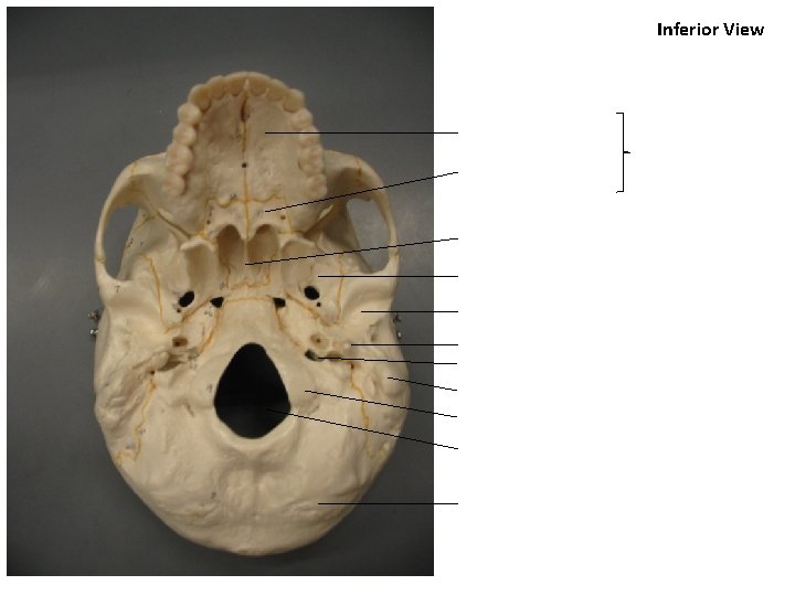 Inferior View 