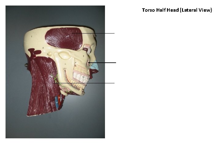 Torso Half Head (Lateral View) 