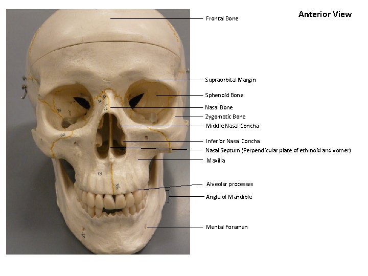 Frontal Bone Anterior View Supraorbital Margin Sphenoid Bone Nasal Bone Zygomatic Bone Middle Nasal