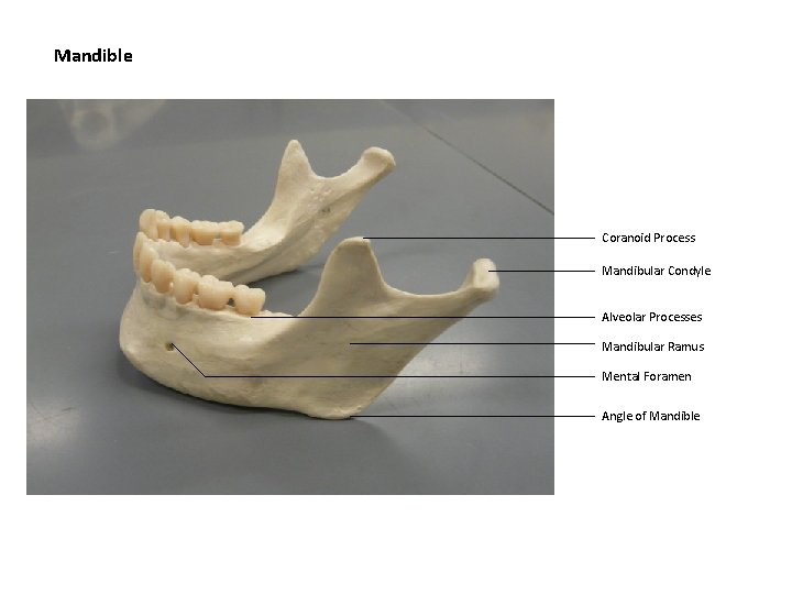 Mandible Coranoid Process Mandibular Condyle Alveolar Processes Mandibular Ramus Mental Foramen Angle of Mandible