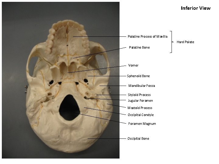 Inferior View Palatine Process of Maxilla Hard Palate Palatine Bone Vomer Sphenoid Bone Mandibular