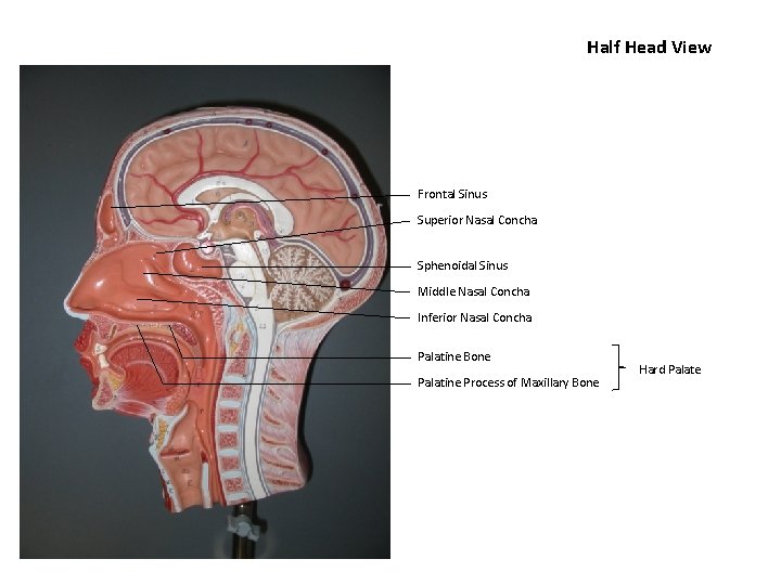 Half Head View Frontal Sinus Superior Nasal Concha Sphenoidal Sinus Middle Nasal Concha Inferior