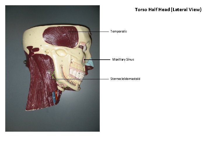 Torso Half Head (Lateral View) Temporalis Maxillary Sinus Sternocleidomastoid 