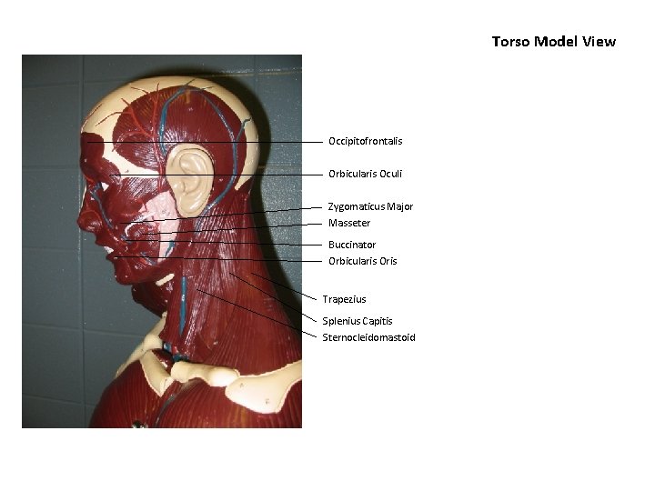 Torso Model View Occipitofrontalis Orbicularis Oculi Zygomaticus Major Masseter Buccinator Orbicularis Oris Trapezius Splenius
