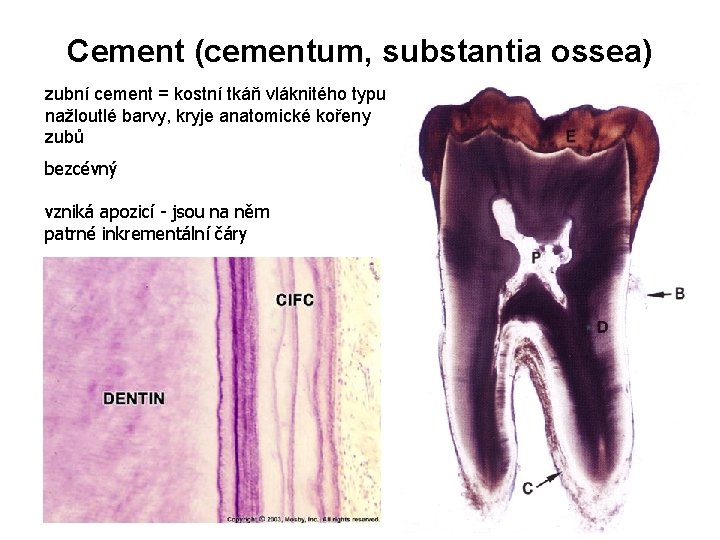 Cement (cementum, substantia ossea) zubní cement = kostní tkáň vláknitého typu nažloutlé barvy, kryje