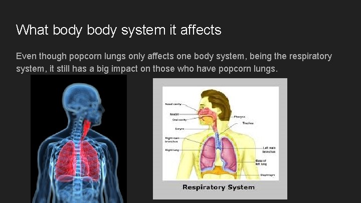 What body system it affects Even though popcorn lungs only affects one body system,
