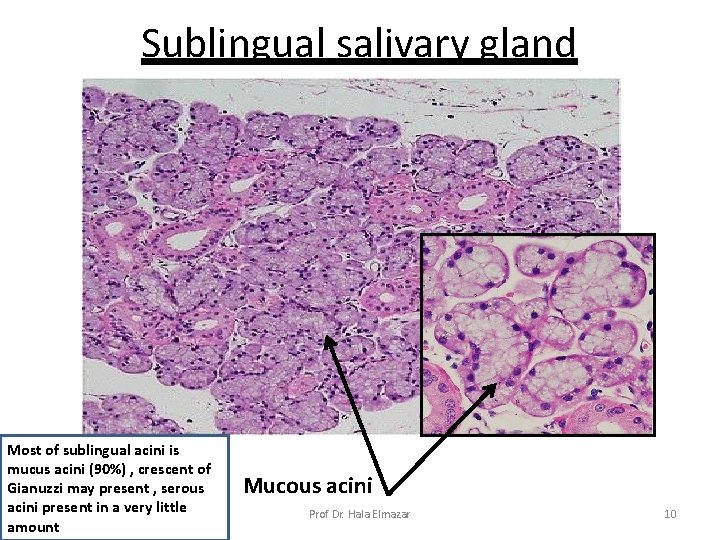 Sublingual salivary gland Most of sublingual acini is mucus acini (90%) , crescent of