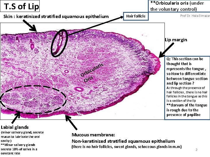 **Orbicularis oris (under the voluntary control) T. S of Lip Skin : keratinized stratified