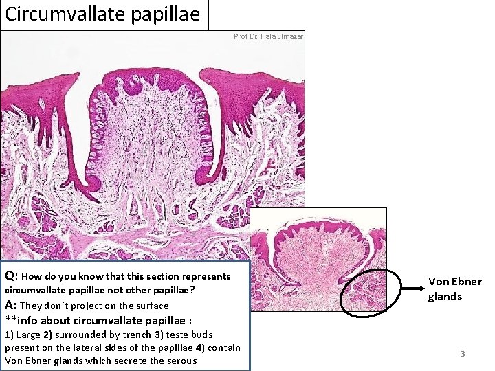 Circumvallate papillae Prof Dr. Hala Elmazar Q: How do you know that this section