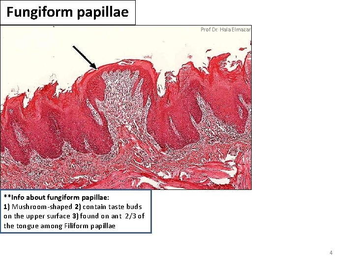 Fungiform papillae Prof Dr. Hala Elmazar **Info about fungiform papillae: 1) Mushroom-shaped 2) contain