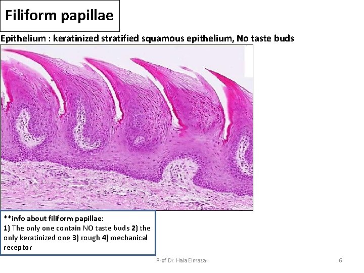 Filiform papillae Epithelium : keratinized stratified squamous epithelium, No taste buds **info about filiform