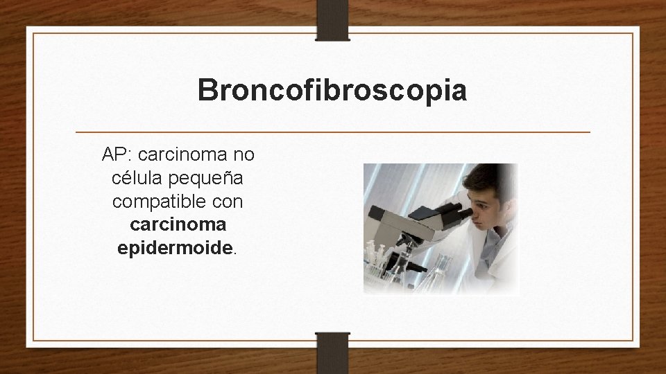 Broncofibroscopia AP: carcinoma no célula pequeña compatible con carcinoma epidermoide. 