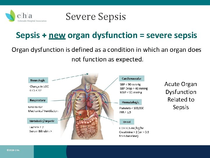 Severe Sepsis + new organ dysfunction = severe sepsis Organ dysfunction is defined as