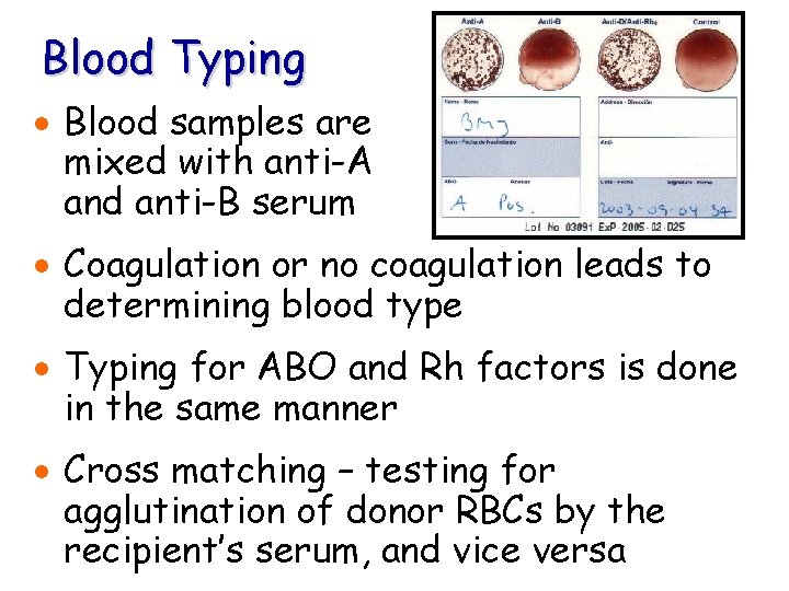 Blood Typing · Blood samples are mixed with anti-A and anti-B serum · Coagulation