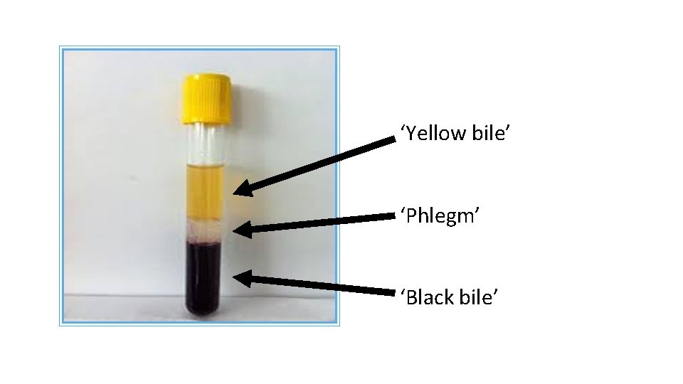 ‘Yellow bile’ ‘Phlegm’ ‘Black bile’ 