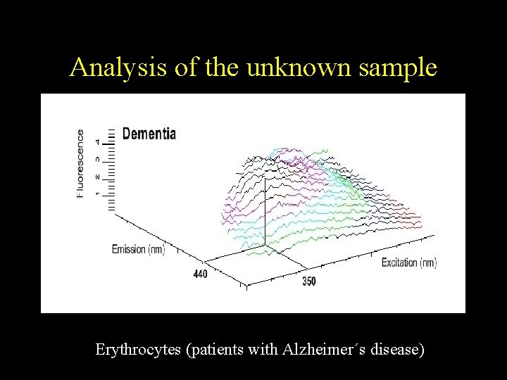 Analysis of the unknown sample Erythrocytes (patients with Alzheimer´s disease) 