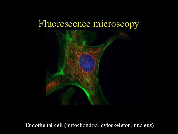 Fluorescence microscopy Endothelial cell (mitochondria, cytoskeleton, nucleus) 