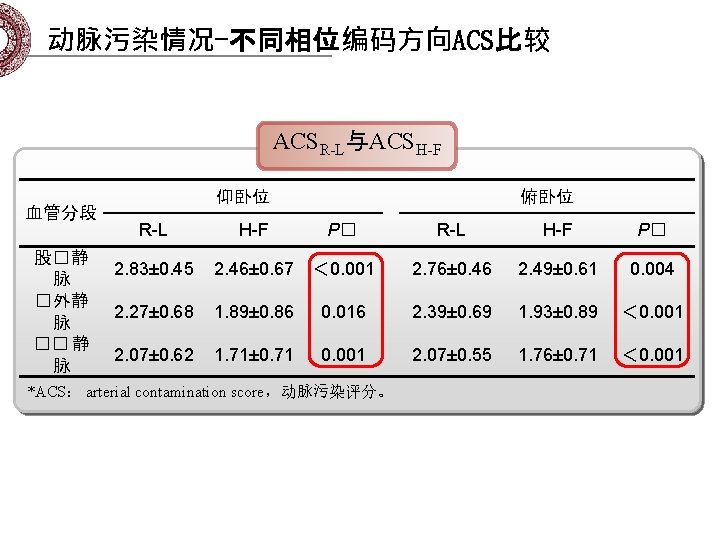动脉污染情况-不同相位编码方向ACS比较 ACSR-L与ACSH-F 血管分段 股� 静 脉 � 外静 脉 �� 静 脉 仰卧位 R-L