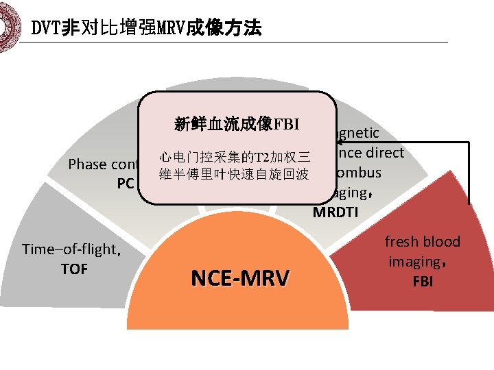 DVT非对比增强MRV成像方法 balanced steady新鲜血流成像FBI magnetic state freeprecession， resonance direct 心电门控采集的T 2加权三 Phase contrast， thrombus B-SSFP
