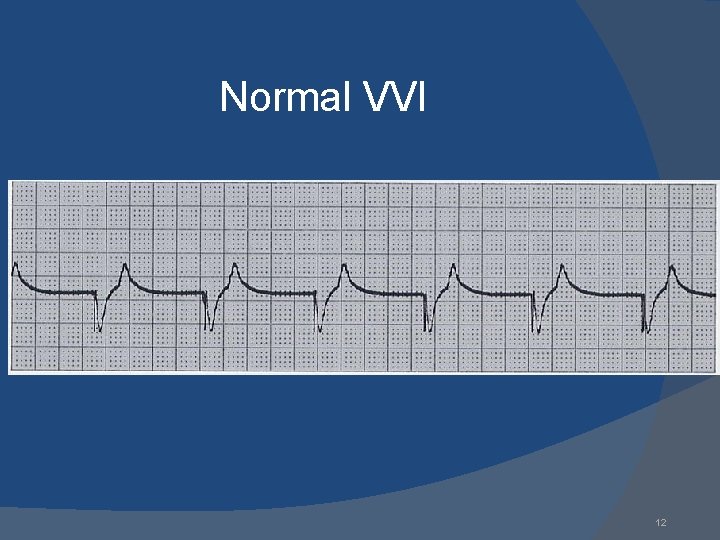 Normal VVI 12 