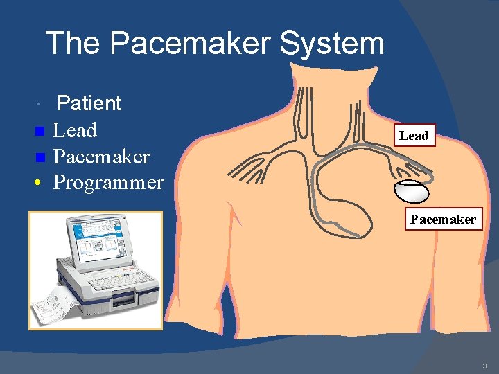 The Pacemaker System Patient Lead n Pacemaker • Programmer n Lead Pacemaker 3 