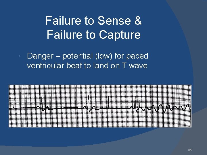 Failure to Sense & Failure to Capture Danger – potential (low) for paced ventricular