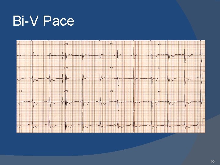 Bi-V Pace 69 