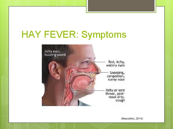 HAY FEVER: Symptoms (Mayoclinic, 2014) 