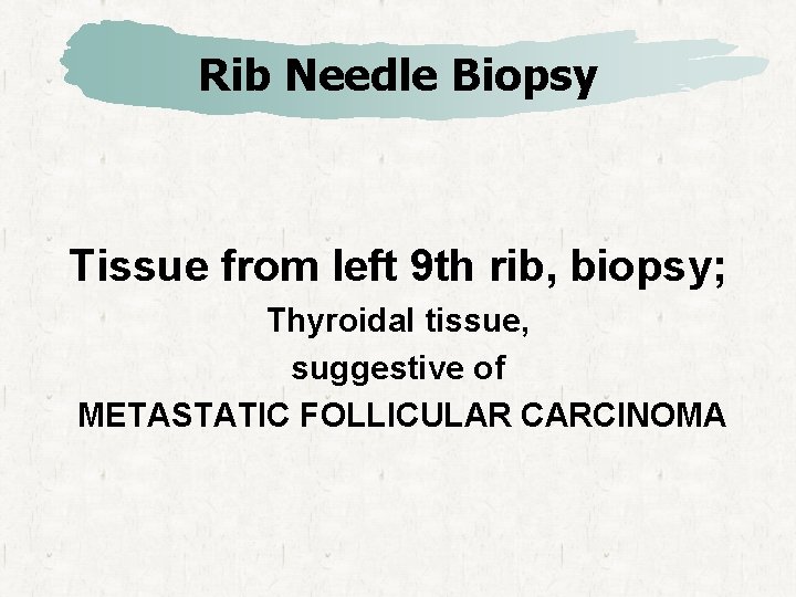 Rib Needle Biopsy Tissue from left 9 th rib, biopsy; Thyroidal tissue, suggestive of