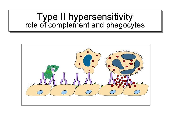 Type II hypersensitivity role of complement and phagocytes 