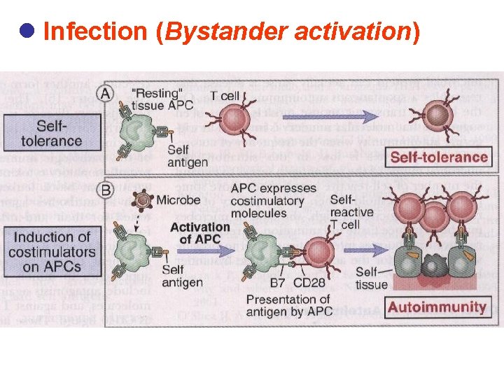 l Infection (Bystander activation) 