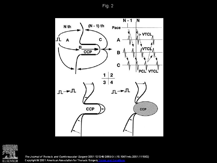 Fig. 2 The Journal of Thoracic and Cardiovascular Surgery 2001 121249 -258 DOI: (10.