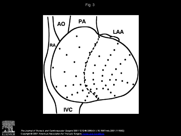 Fig. 3 The Journal of Thoracic and Cardiovascular Surgery 2001 121249 -258 DOI: (10.