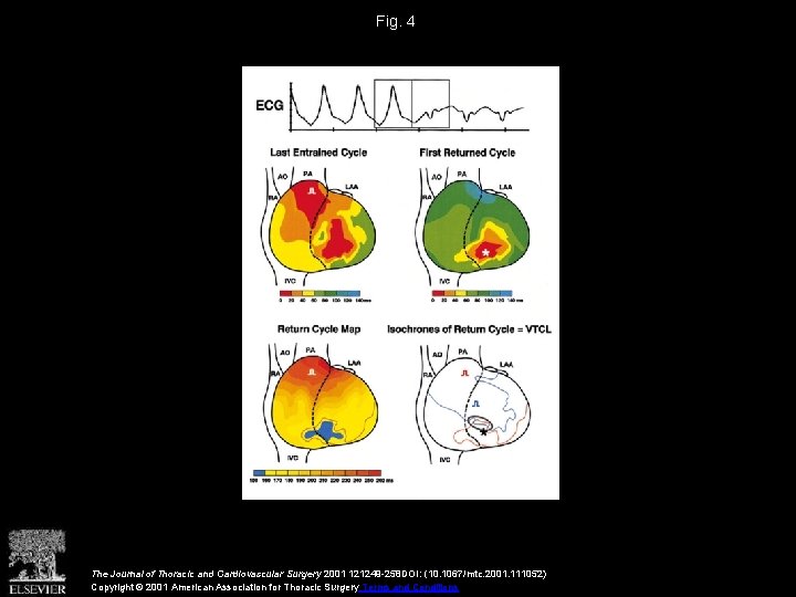 Fig. 4 The Journal of Thoracic and Cardiovascular Surgery 2001 121249 -258 DOI: (10.