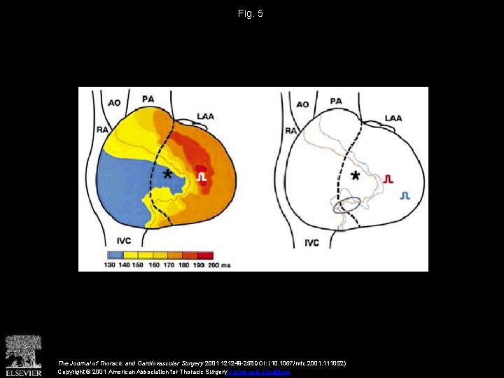 Fig. 5 The Journal of Thoracic and Cardiovascular Surgery 2001 121249 -258 DOI: (10.
