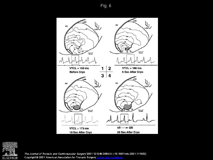 Fig. 6 The Journal of Thoracic and Cardiovascular Surgery 2001 121249 -258 DOI: (10.