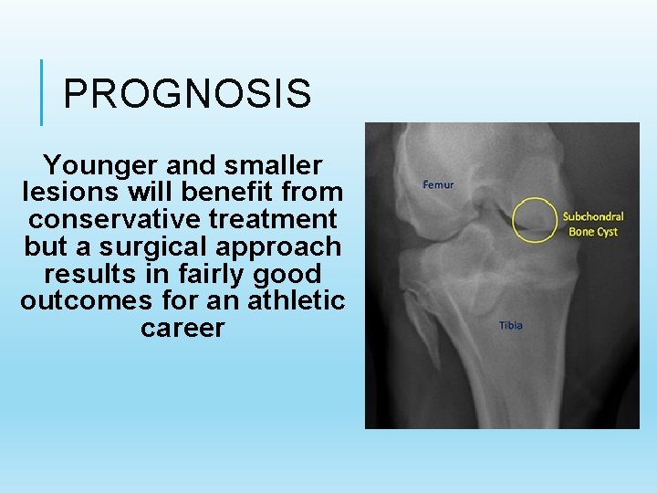 PROGNOSIS Younger and smaller lesions will benefit from conservative treatment but a surgical approach