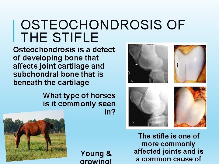 OSTEOCHONDROSIS OF THE STIFLE Osteochondrosis is a defect of developing bone that affects joint