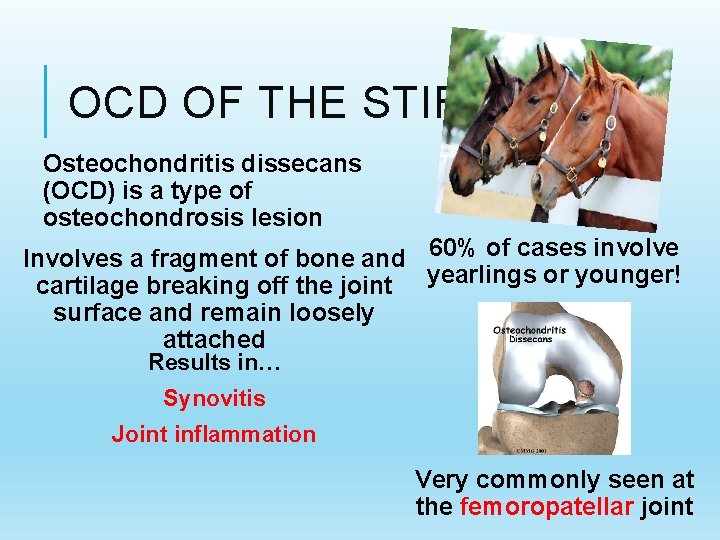 OCD OF THE STIFLE Osteochondritis dissecans (OCD) is a type of osteochondrosis lesion Involves